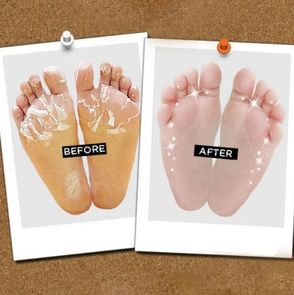 DOUBLE EFFECT FOOT PEELING MASK [1 Pair]