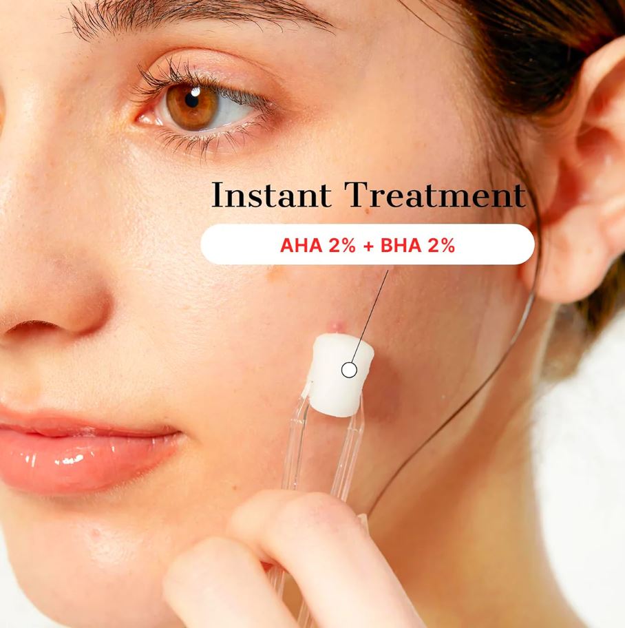 THE AHA 2 BHA 2 BLEMISH TREATMENT SERUM [50g, 30+ cotton balls]